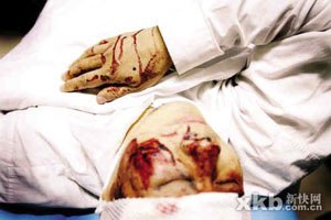 买凶围殴业主 开发商欲20万威逼私了